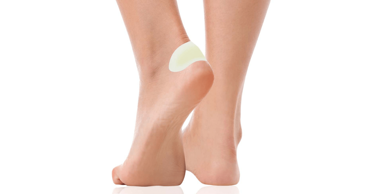 Voetblaar voorkomen en behandelen